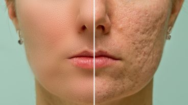 ২ মিনিটের ফটোশপ টিটোরিয়াল  Best Photo Retouching