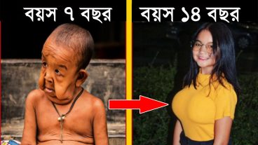 পৃথিবীর সবচেয়ে অদ্ভুত কিছু শিশু