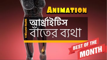 আর্থ্রাইটিস/বাঁতের ব্যথা কি এবং এর চিকিৎসা [Animated]