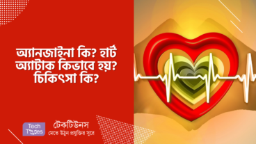 অ্যানজাইনা কি? হার্ট অ্যাটাক কিভাবে হয়? চিকিৎসা কি?