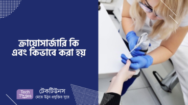 ক্রায়োসার্জারি কি এবং কিভাবে করা হয়