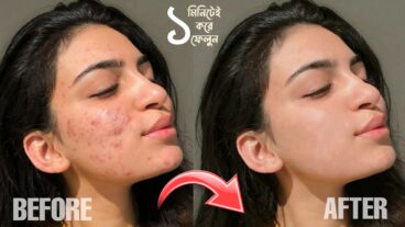 মুখের যে কোনো দাগ এখন মুছে ফেলুন এক ক্লিকেই
