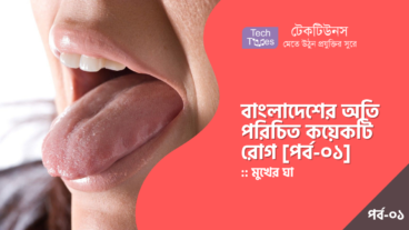 বাংলাদেশের অতি পরিচিত কয়েকটি রোগ [পর্ব-০১] :: মুখের ঘা