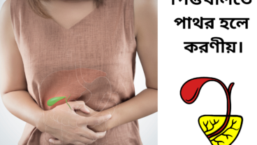 পিত্তথলিতে পাথর হলে কি করবেন