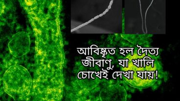 আবিষ্কৃত হল দৈত্য জীবাণু যা খালি চোখেই দেখা যায়!