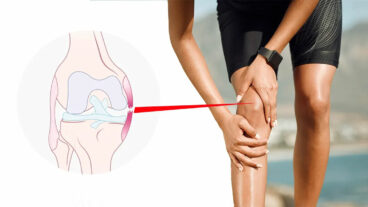 লিগামেন্ট ছিড়ে যাওয়ার লক্ষণ ও চিকিৎসা