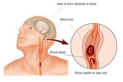 হয়তো আপনিও কারো জীবন বাঁচাতে পারবেন ((ননটেকি পোস্ট))