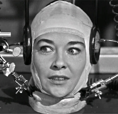 এবার মাথা প্রতিস্থাপন !!! এও কি সম্ভব?