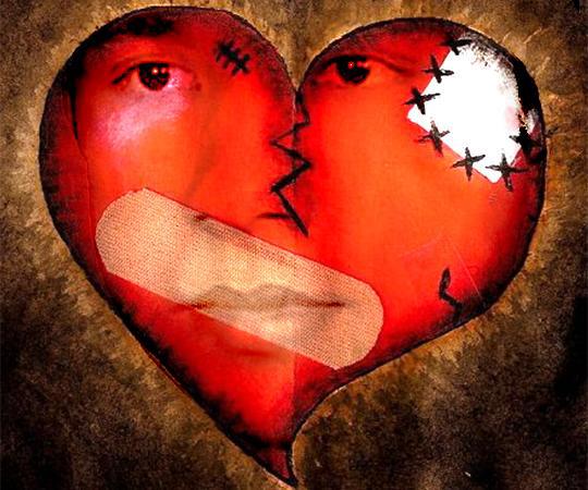 ছবির অবাঞ্ছিত স্পট  দূর করুন  Adobe photoshop দিয়ে