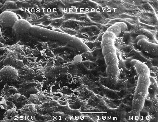 <i>Nostoc</i> জগতের এক অদ্ভূত সায়ানোব্যাকটেরিয়া।