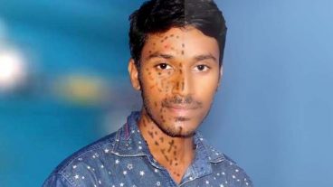 Photoshope 7.0 :: এক ক্লিকে ছবিকে করুন দাগ মুক্ত। noise ware-pro plugin ডাউনলোড করে নিন নয়েস প্রোফেশনাল প্লাগিন যারা ফটোশপ 7.0  এবং উইন্ডোস XP ব্যবহার করেন তাদের জন্য।