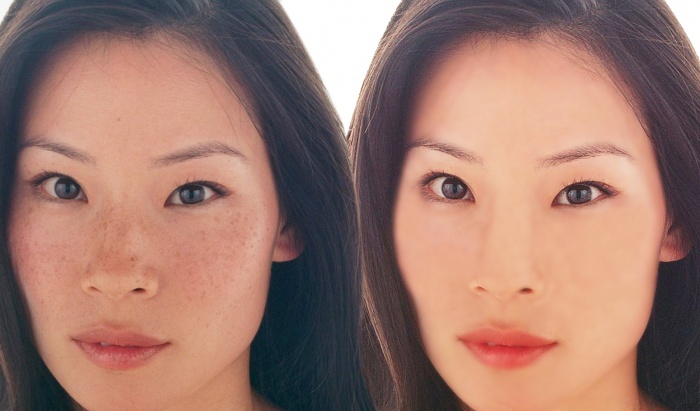 মুখের যত কালো দাগ, ব্রন, তিল দূর করুন নিমেষে স্কিনকে করুন soft আর smooth