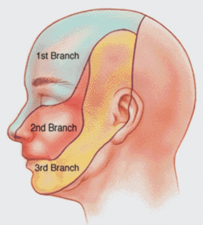 মানুষের করোটিক স্নায়ুর নাম , কাজ মনে রাখার সহজ পদ্বতি (গল্পের মাধ্যমে!!!!!!!!)